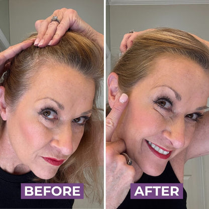 HairMagic+ Hairline Powder For Gray Roots