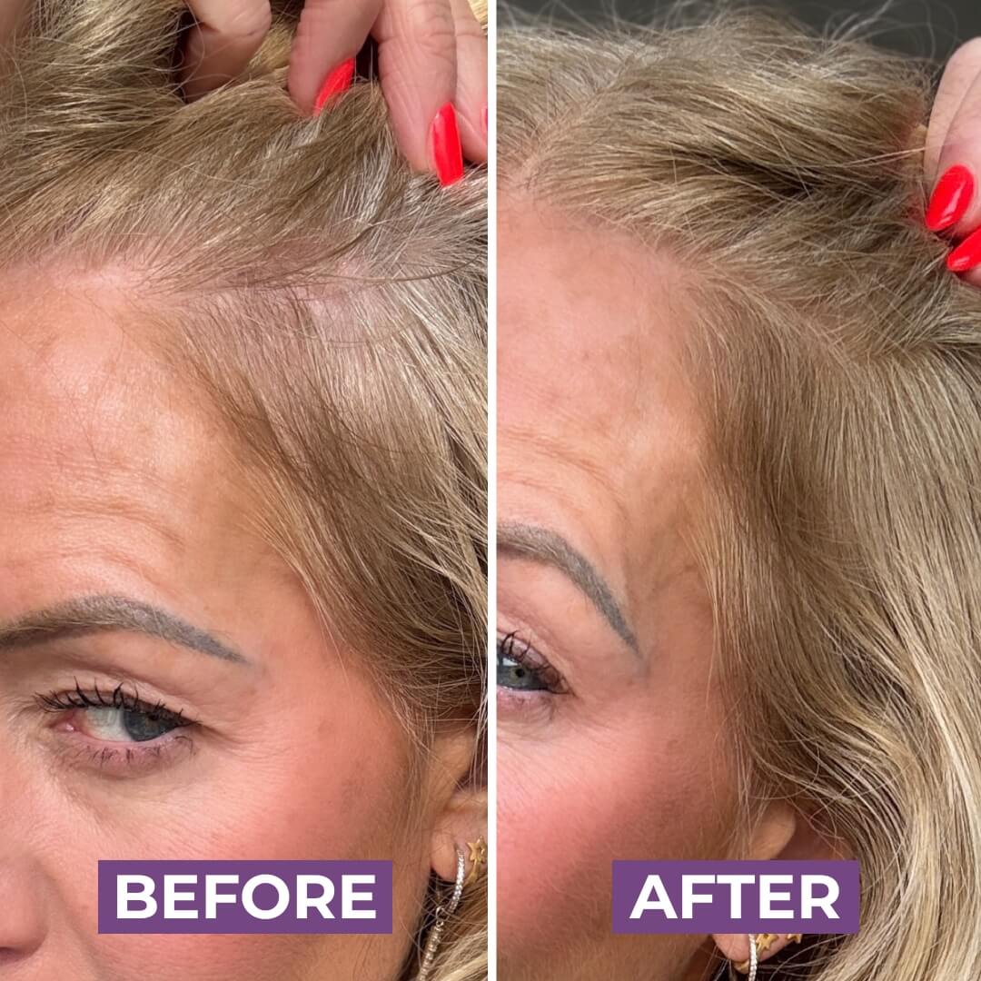 HairMagic+ Hairline Powder For Gray Roots