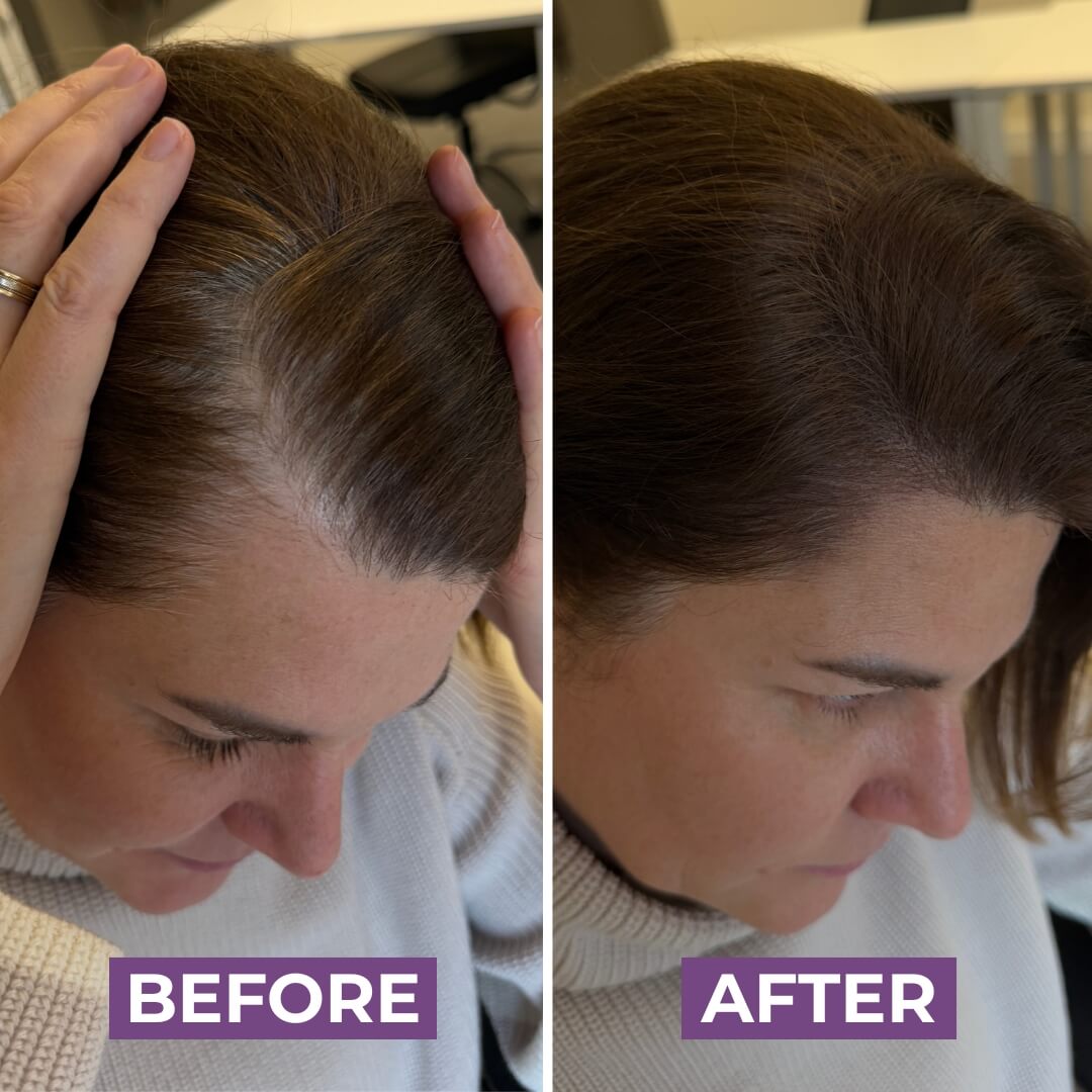 HairMagic+ Hairline Powder For Gray Roots